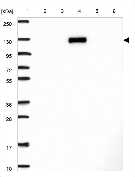Anti-RTEL1 Antibody