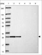 Anti-MRPL9 Antibody