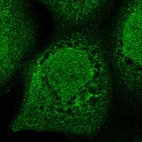 Immunofluorescent staining of human cell line A-431 shows localization to nucleoplasm & endoplasmic reticulum.