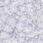 Immunohistochemical staining of human kidney shows no positivity in cells in tubules as expected.