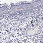 Immunohistochemical staining of human skin shows very weak positivity in squamous epithelial cells.