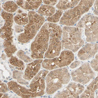 Immunohistochemical staining of human kidney shows moderate cytoplasmic positivity in cells in tubules.