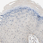 Immunohistochemical staining of human skin shows no positivity in squamous epithelial cells as expected.