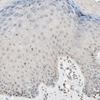 Immunohistochemical staining of human skin shows no staining in squamous epithelial cells as expected.