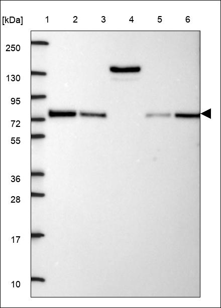 Anti-PGM2 Antibody