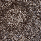 Immunohistochemical staining of human lymph node shows strong nuclear positivity in germinal center cells.