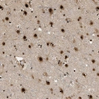 Immunohistochemical staining of human cerebral cortex shows strong nuclear positivity in neuronal cells.