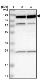 Lane 1: Marker [kDa] 230, 130, 95, 72, 56, 36, 28, 17, 11_br/_Lane 2: Human cell line RT-4_br/_Lane 3: Human cell line U-251MG sp