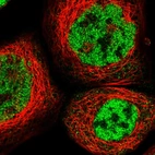 Immunofluorescent staining of human cell line A-431 shows localization to nucleoplasm.