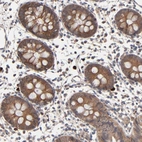 Immunohistochemical staining of human colon shows strong cytoplasmic positivity in glandular cells.