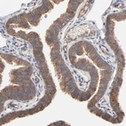 Immunohistochemical staining of human fallopian tube shows moderate cytoplasmic positivity in glandular cells.