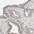Immunohistochemical staining of human prostate shows weak cytoplasmic positivity in glandular cells.