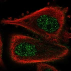 Immunofluorescent staining of human cell line PC-3 shows localization to nucleoplasm & plasma membrane.