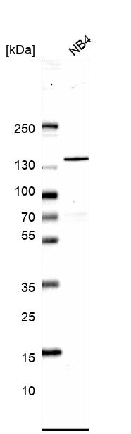 Anti-SRRM1 Antibody