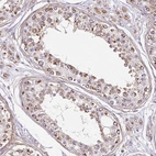 Immunohistochemical staining of human testis shows strong cytoplasmic granular positivity in cells in seminiferous ducts.