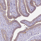 Immunohistochemical staining of human fallopian tube shows moderate cytoplasmic granular positivity in glandular cells.