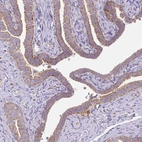 Immunohistochemical staining of human fallopian tube shows moderate cytoplasmic granular positivity in glandular cells.