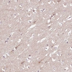 Immunohistochemical staining of human cerebral cortex shows moderate cytoplasmic granular positivity in neurons.