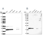 Western blot analysis using Anti-NDUFAF2 antibody HPA054776 (A) shows similar pattern to independent antibody HPA048082 (B).
