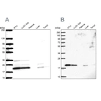 Western blot analysis using Anti-NDUFAF2 antibody HPA054776 (A) shows similar pattern to independent antibody HPA048082 (B).