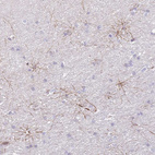Immunohistochemical staining of human cerebral cortex shows moderate cytoplasmic positivity in glial cells.
