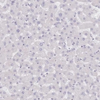 Immunohistochemical staining of human liver shows no cytoplasmic positivity in hepatocytes as expected.