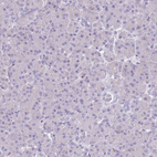 Immunohistochemical staining of human pancreas shows no cytoplasmic positivity in exocrine glandular cells as expected.