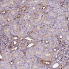 Immunohistochemical staining of human kidney shows strong membranous positivity in cells in tubules.
