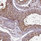 Immunohistochemical staining of human testis shows strong membranous positivity in cells in seminiferous ducts.