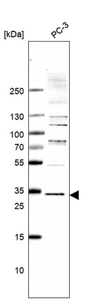 Western blot analysis in human cell line PC-3.