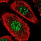 Immunofluorescent staining of human cell line PC-3 shows localization to nucleoplasm.