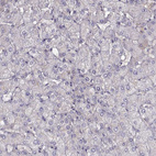 Immunohistochemical staining of human liver shows no positivity in hepatocytes as expected.