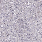 Immunohistochemical staining of human liver shows no positivity in hepatocytes as expected.
