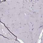 Immunohistochemical staining of human skeletal muscle shows no positivity in myocytes as expected.