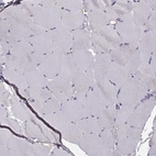Immunohistochemical staining of human skeletal muscle shows no positivity in myocytes as expected.