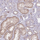 Immunohistochemical staining of human kidney shows moderate cytoplasmic positivity in cells in tubules.