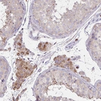 Immunohistochemical staining of human testis shows moderate membranous/cytoplasmic positivity in Leydig cells.