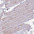 Immunohistochemical staining of human heart muscle shows weak cytoplasmic positivity in cardiomyocytes.