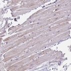 Immunohistochemical staining of human heart muscle shows weak cytoplasmic positivity in cardiomyocytes.