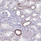 Immunohistochemical staining of human kidney shows moderate cytoplasmic positivity in cells in distal tubules.