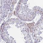 Immunohistochemical staining of human testis shows weak cytoplasmic positivity in Leydig cells.