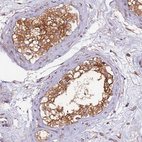 Immunohistochemical staining of human testis shows strong membranous-cytoplasmic positivity in cells in seminiferous ducts.