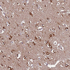 Immunohistochemical staining of human cerebral cortex shows strong membranous-cytoplasmic positivity in neurons, glial cells and neuropil.