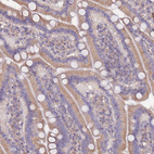 Immunohistochemical staining of human duodenum shows moderate membranous-cytoplasmic positivity in glandular cells.