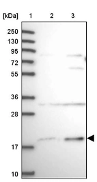 Lane 1: Marker [kDa] 250, 130, 95, 72, 55, 36, 28, 17, 10_br/_Lane 2: Human cell line RT-4_br/_Lane 3: Human cell line U-251MG sp