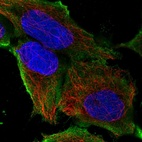 Immunofluorescent staining of human cell line HEK 293 shows localization to plasma membrane.