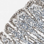 Immunohistochemical staining of human rectum shows strong nuclear positivity in glandular cells.
