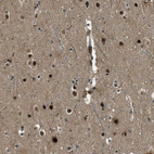 Immunohistochemical staining of human cerebral cortex shows strong nuclear positivity in neuronal cells.
