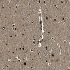 Immunohistochemical staining of human cerebral cortex shows strong nuclear positivity in neuronal cells.