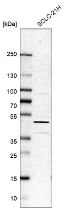 Western blot analysis in human cell line SCLC-21H.
